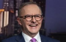 أنتوني ألبانيز