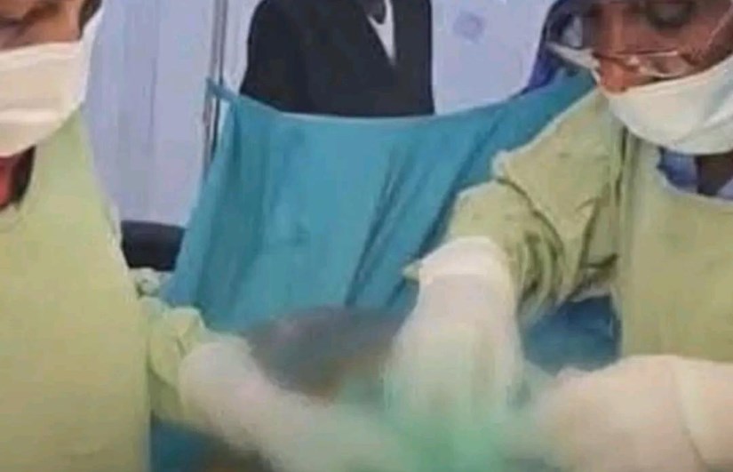 جراحة نادرة